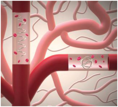 Graphical abstract showing fully iron microrobots moving through blood vessels